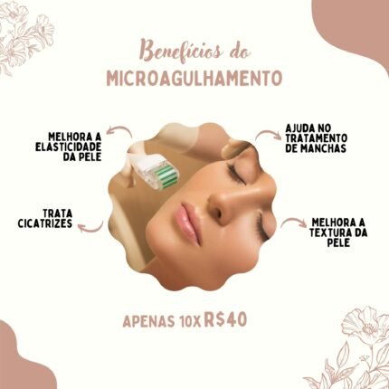 Microagulhamento em Curitiba